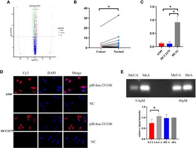 piR-hsa-211106 Inhibits the Progression of Lung Adenocarcinoma Through Pyruvate Carboxylase and Enhances Chemotherapy Sensitivity